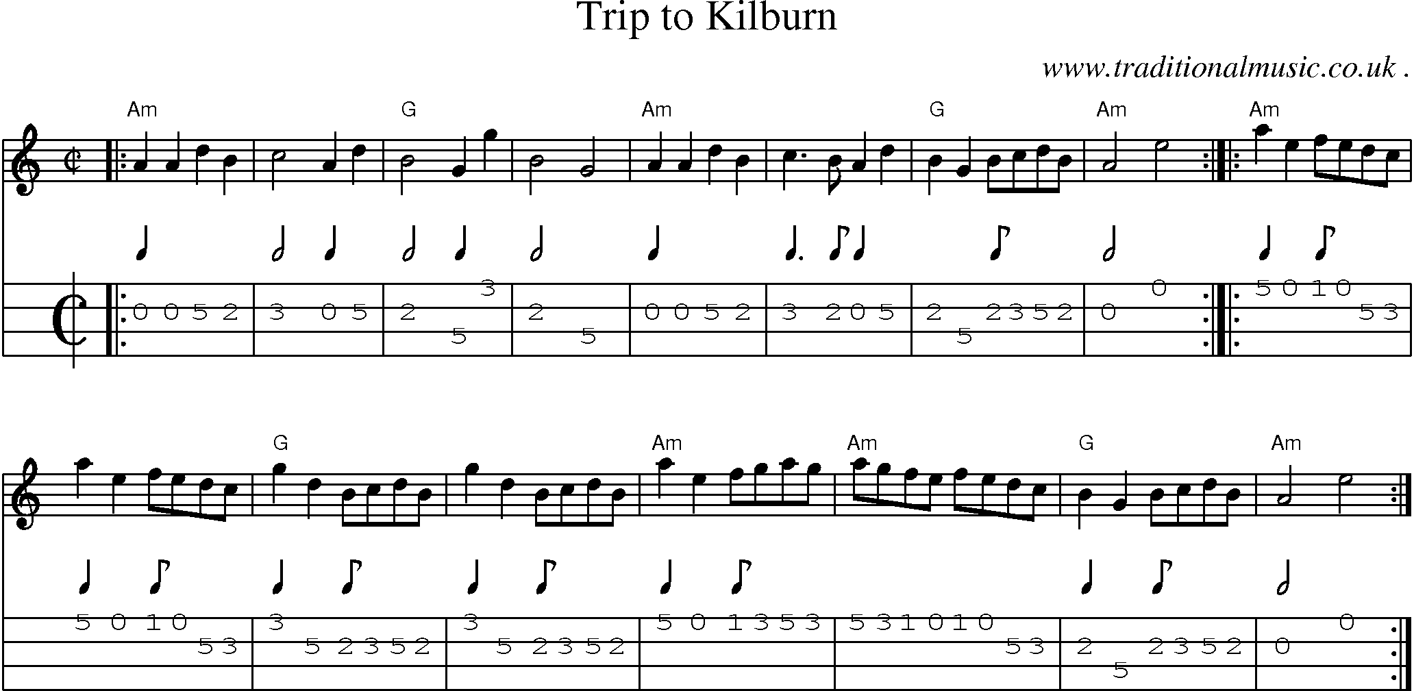 Sheet-Music and Mandolin Tabs for Trip To Kilburn